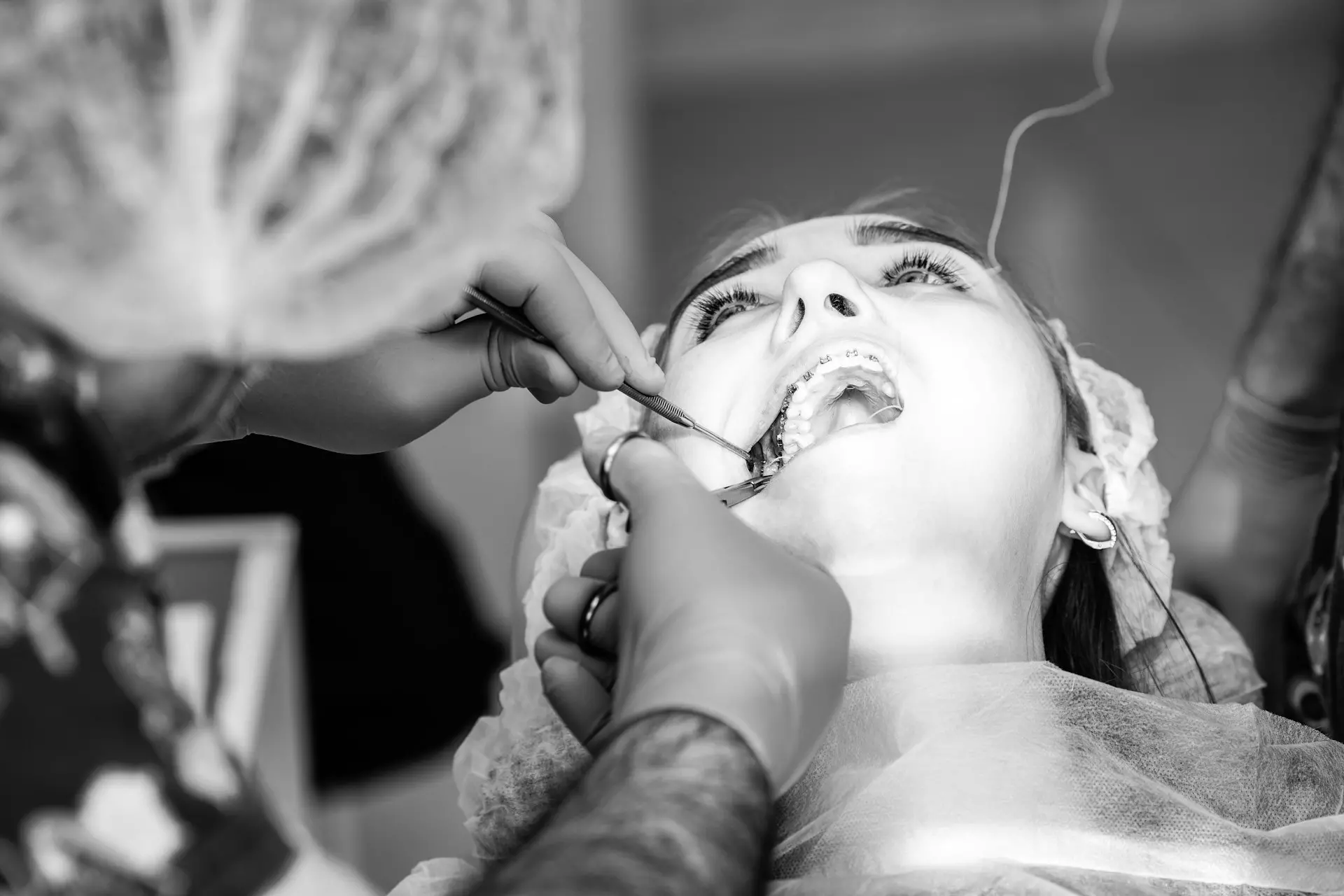  A comprehensive comparison of titanium alloy and ceramic dental implant materials: Which one is better for you? 